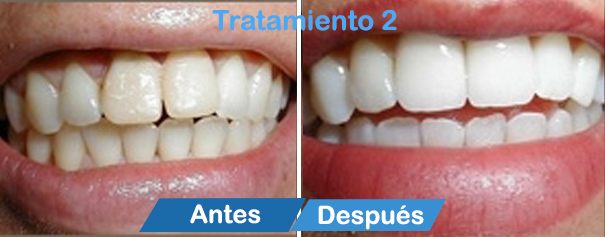 dentistas en cancun